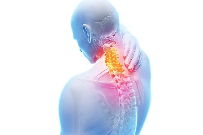 Text Neck Syndrome 2 image 12