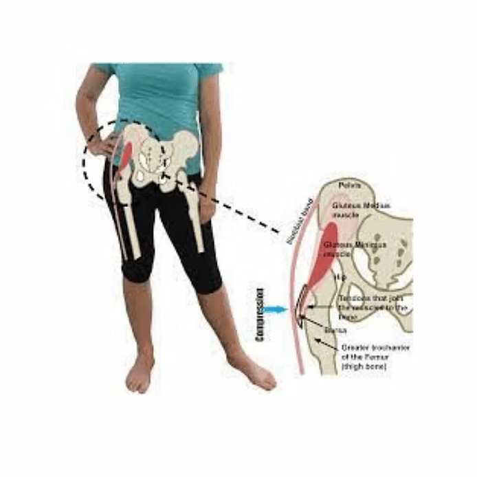 Lateral Hip pain 1 image 14
