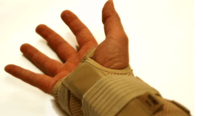 Carpal tunnel Syndrome 3 image 2