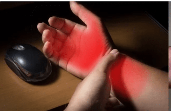 Carpal tunnel Syndrome 1 image